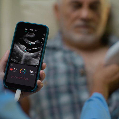 Interface showing Exo's medical imaging platform with ultrasound visualization
